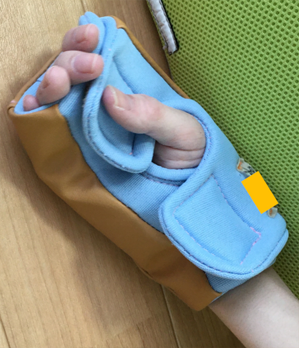 四肢の保護サポータの写真