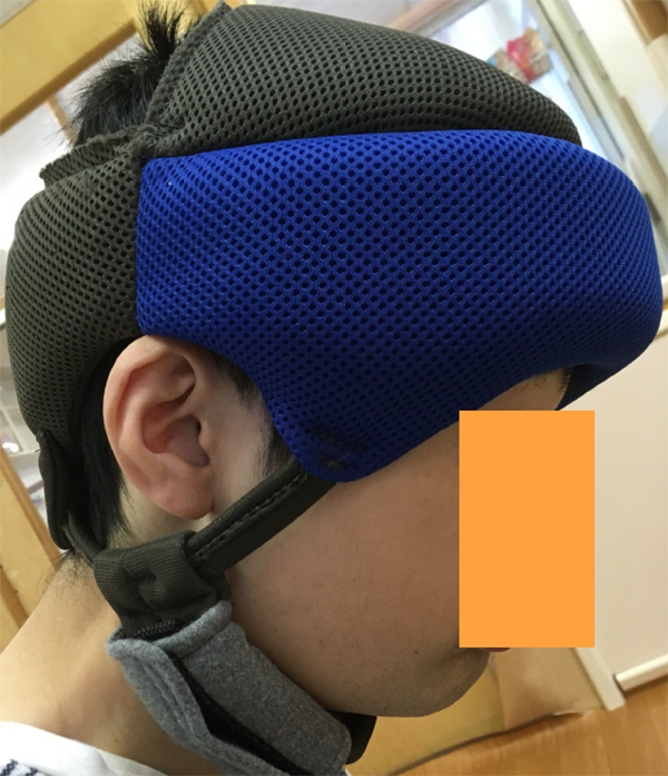 頭部保護帽の写真